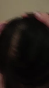 口